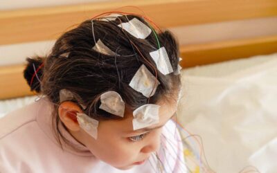 Epilepsia en Niños. La importancia de conocer esta enfermedad