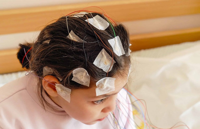 Epilepsia En Niños La Importancia De Conocer Esta Enfermedad Ceni Centro De Neurología Infantil 4578